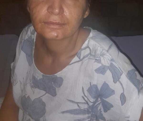 WhatsApp Image 2025-12-03 at 15.19.04_29eb6fa6 Magnifiller